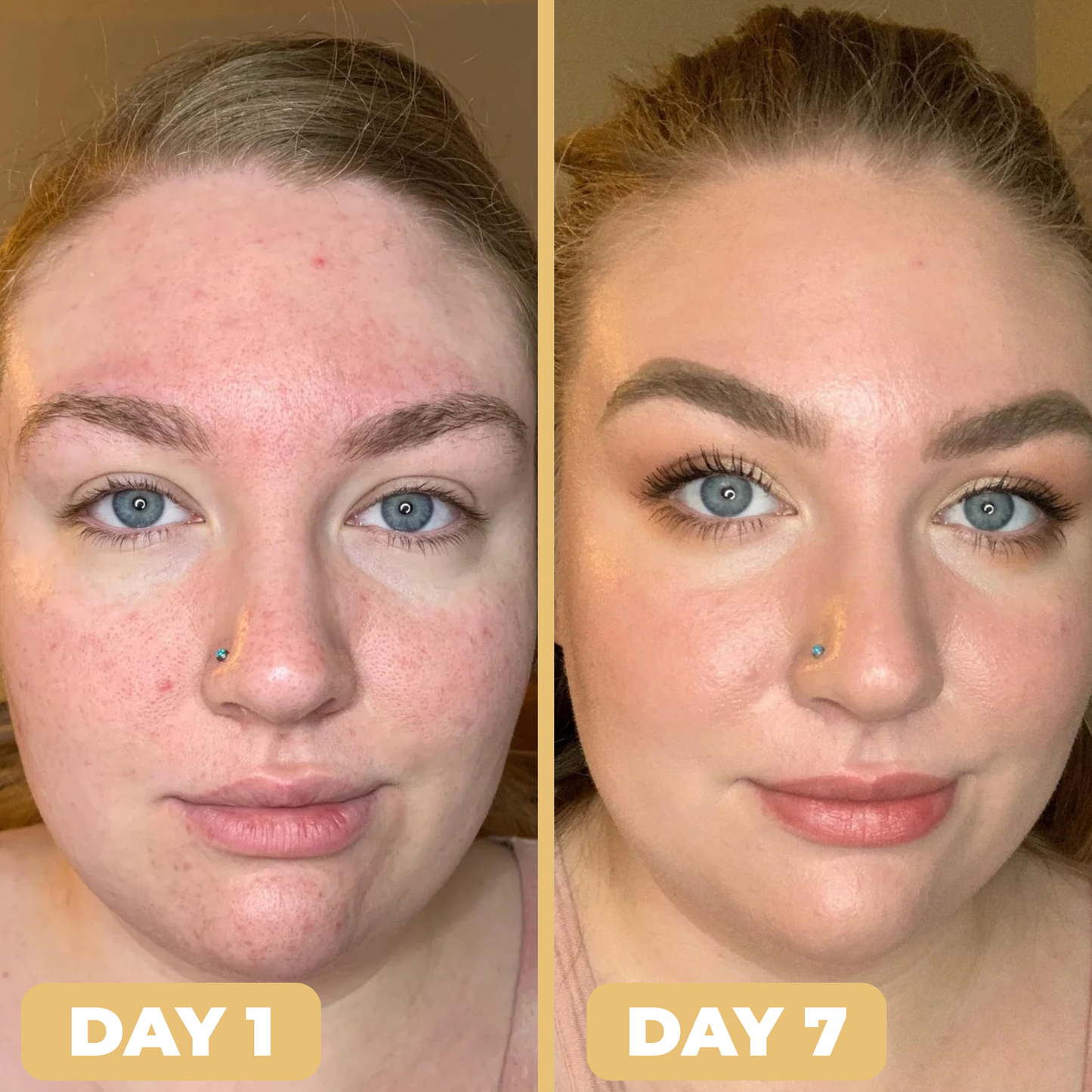 SkinBloom Capsule Cream