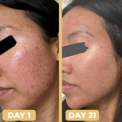 SkinBloom Capsule Cream